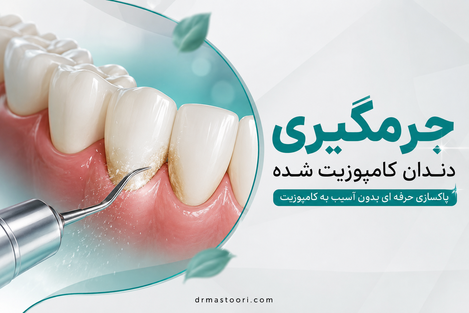 جرمگیری دندان کامپوزیت شده